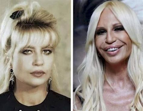 donatella versace avant chirugie|donatella versace face what happened.